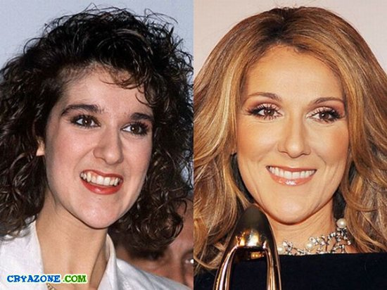 Фотографии знаменитостей до и после стоматолога