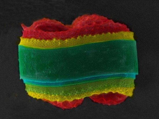 Фотографии микроскопических водорослей