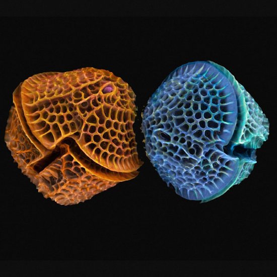 Фотографии микроскопических водорослей